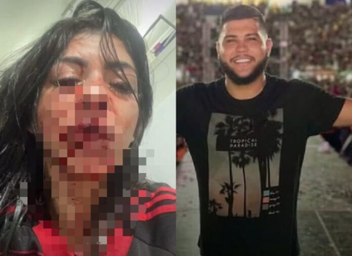 Mulher com rosto machucado após violência contra a mulher em Manaus, 2025.