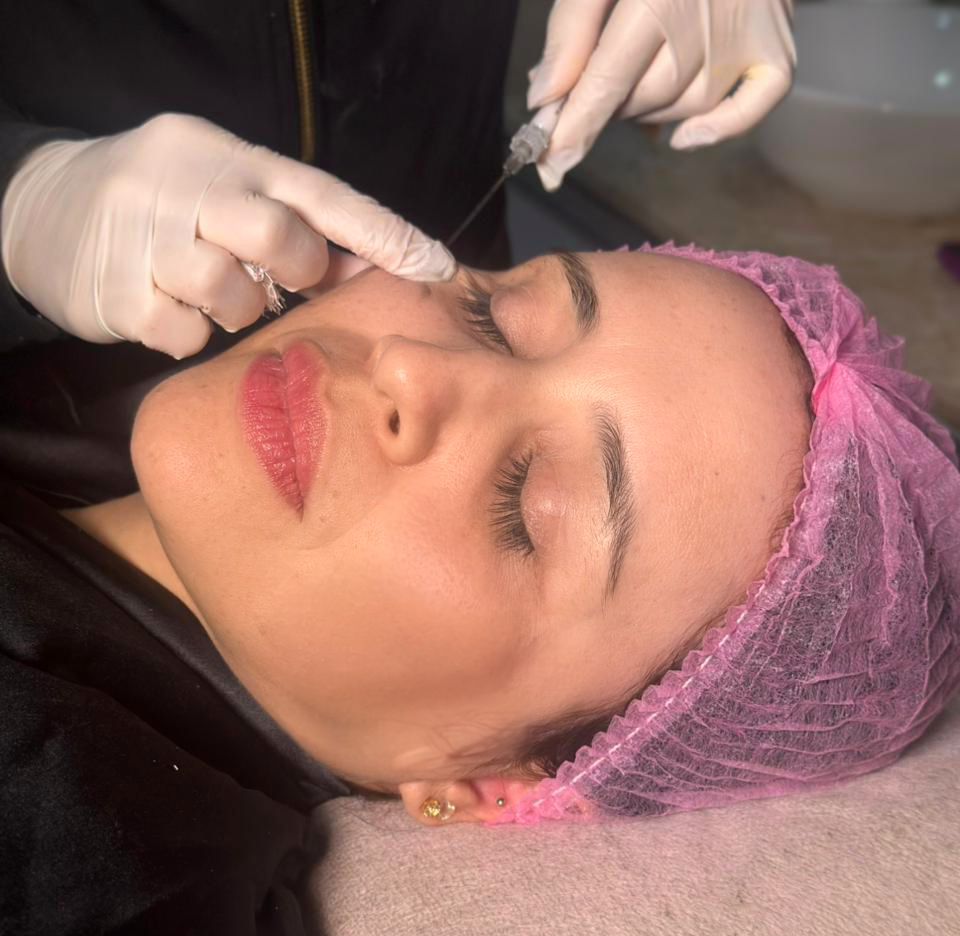 flacidez, emagrecimento rápido, bioestimulador de colágeno, Ozempic, prevenção, estética facial, cuidados com a pele